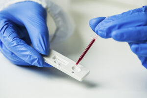 Diferencias químicas en los test de COVID-19