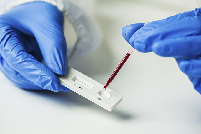 Unas manos con guantes aplican una muestra de sangre sobre un test COVID para identificar la presencia de coronavirus